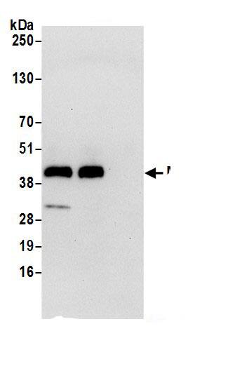 Immunoprecipitation:Mannose Phosphate Isomerase AntibodyNBP3-30371] -Detection of human MPI by western blot of immunoprecipitates. Samples: Whole cell lysate (0.5 or 1.0 mg per IP reaction; 20% of IP loaded) from 293T cells prepared using NETN lysis buffer. Antibodies: Affinity purified rabbit anti-MPI antibody NBP3-30371 (lot NBP3-30371-1) used for IP at 6 µg per reaction. MPI was also immunoprecipitated by rabbit anti-MPI.. For blotting immunoprecipitated MPI, NBP3-30371 was used at 1 µg/ml. Detection: Chemiluminescence with an exposure time of 30 seconds.