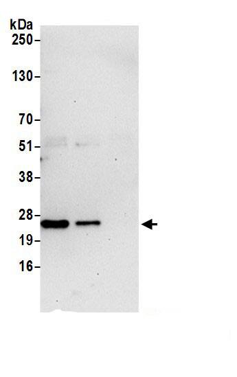 Immunoprecipitation:DTYMK AntibodyNBP3-30372] -Detection of human DTYMK by western blot of immunoprecipitates. Samples: Whole cell lysate (0.5 or 1.0 mg per IP reaction; 20% of IP loaded) from 293T cells prepared using NETN lysis buffer. Antibodies: Affinity purified rabbit anti-DTYMK antibody (NBP3-30372 lot 1) used for IP at 6 µg per reaction. DTYMK was also immunoprecipitated by rabbit anti-DTYMK.. For blotting immunoprecipitated DTYMK, NBP3-30372 was used at 0.4 mg/ml. Detection: Chemiluminescence with an exposure time of 30 seconds.