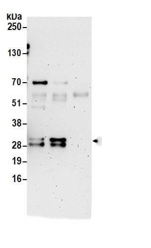 Immunoprecipitation:C9orf40 AntibodyNBP3-30374] -Detection of human C9orf40 by western blot of immunoprecipitates. Samples: Whole cell lysate (0.5 or 1.0 mg per IP reaction; 20% of IP loaded) from 293T cells prepared using NETN lysis buffer. Antibodies: Affinity purified rabbit anti-C9orf40 antibody NBP3-30374 (lot NBP3-30374-1) used for IP at 6 µg per reaction. C9orf40 was also immunoprecipitated by rabbit anti-C9orf40 antibody BL18113. For blotting immunoprecipitated C9orf40, NBP3-30374 was used at 0.4 µg/ml. Detection: Chemiluminescence with an exposure time of 3 minutes.