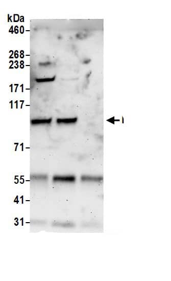 Immunoprecipitation:NVL AntibodyNBP3-30375] -Detection of human NVL by western blot of immunoprecipitates. Samples: Whole cell lysate (0.5 or 1.0 mg per IP reaction; 20% of IP loaded) from HeLa cells prepared using NETN lysis buffer. Antibody: Affinity purified rabbit anti-NVL antibody NBP3-30375 (lot NBP3-30375-1) used for IP at 6 µg per reaction. NVL was also immunoprecipitated by rabbit anti-NVL.. For blotting immunoprecipitated NVL, NBP3-30375 was used at 1 µg/ml. Detection: Chemiluminescence with an exposure time of 3 minutes.