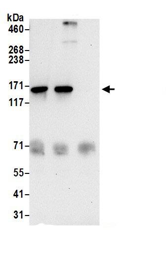 Immunoprecipitation:TBC1D9B AntibodyNBP3-30377] -Detection of human TBC1D9B by western blot of immunoprecipitates. Samples: Whole cell lysate (0.5 or 1.0 mg per IP reaction; 20% of IP loaded) from 293T cells prepared using NETN lysis buffer. Antibodies: Affinity purified rabbit anti-TBC1D9B antibody NBP3-30377 (lot NBP3-30377-1) used for IP at 6 µg per reaction. TBC1D9B was also immunoprecipitated by rabbit anti-TBC1D9B.. For blotting immunoprecipitated TBC1D9B, NBP3-30377 was used at 1 µg/ml. Detection: Chemiluminescence with an exposure time of 30 seconds.