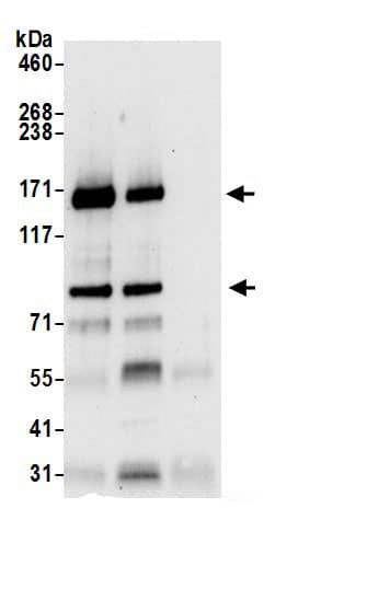 Immunoprecipitation:IRS4 AntibodyNBP3-30379] -Detection of human IRS4 by western blot of immunoprecipitates. Samples: Whole cell lysate (0.5 or 1.0 mg per IP reaction; 20% of IP loaded) from 293T cells prepared using NETN lysis buffer. Antibodies: Affinity purified rabbit anti-IRS4 antibody NBP3-30379 (lot NBP3-30379-1) used for IP at 6 µg per reaction. IRS4 was also immunoprecipitated by rabbit anti-IRS4.. For blotting immunoprecipitated IRS4, NBP3-30379 was used at 0.4 µg/ml. Detection: Chemiluminescence with an exposure time of 30 seconds.