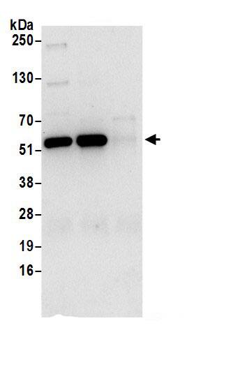 Immunoprecipitation:SHMT2 AntibodyNBP3-30380] -Detection of human SHMT2 by western blot of immunoprecipitates. Samples: Whole cell lysate (0.5 or 1.0 mg per IP reaction; 20% of IP loaded) from 293T cells prepared using NETN lysis buffer. Antibodies: Affinity purified rabbit anti-SHMT2 antibody NBP3-30380 (lot NBP3-30380-1) used for IP at 6 µg per reaction. SHMT2 was also immunoprecipitated by rabbit anti-SHMT2.. For blotting immunoprecipitated SHMT2, NBP3-30380 was used at 0.4 µg/ml. Detection: Chemiluminescence with an exposure time of 10 seconds.