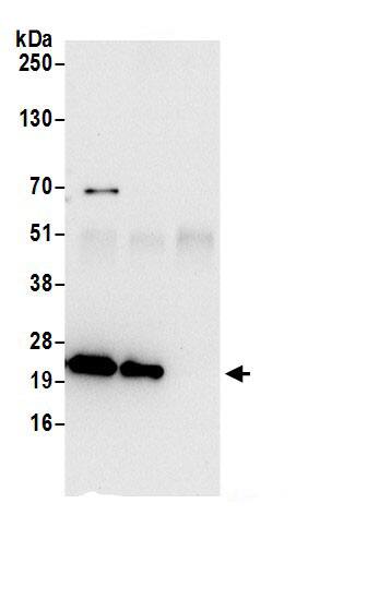 Immunoprecipitation:ATP5F1 AntibodyNBP3-30382] -Detection of human ATP5F1 by western blot of immunoprecipitates. Samples: Whole cell lysate (0.5 or 1.0 mg per IP reaction; 20% of IP loaded) from 293T cells prepared using NETN lysis buffer. Antibodies: Affinity purified rabbit anti-ATP5F1 antibody NBP3-30382 (lot NBP3-30382-1) used for IP at 6 µg per reaction. ATP5F1 was also immunoprecipitated by rabbit anti-ATP5F1.. For blotting immunoprecipitated ATP5F1, NBP3-30382 was used at 1 µg/ml. Detection: Chemiluminescence with an exposure time of 10 seconds.