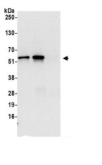 Immunoprecipitation:OXCT1 AntibodyNBP3-30384] -Detection of human OXCT1 by western blot of immunoprecipitates. Samples: Whole cell lysate (0.5 or 1.0 mg per IP reaction; 20% of IP loaded) from 293T cells prepared using NETN lysis buffer. Antibodies: Affinity purified rabbit anti-OXCT1 antibody NBP3-30384 (lot NBP3-30384-1) used for IP at 6 µg per reaction. OXCT1 was also immunoprecipitated by rabbit anti-OXCT1.. For blotting immunoprecipitated OXCT1, NBP3-30384 was used at 1 µg/ml. Detection: Chemiluminescence with an exposure time of 10 seconds.