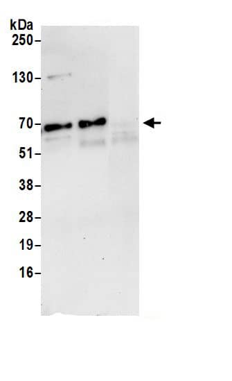 Immunoprecipitation:NUP62 AntibodyNBP3-30385] -Detection of human NUP62 by western blot of immunoprecipitates. Samples: Whole cell lysate (0.5 or 1.0 mg per IP reaction; 20% of IP loaded) from 293T cells prepared using NETN lysis buffer. Antibodies: Affinity purified rabbit anti-NUP62 antibody NBP3-30385 (lot NBP3-30385-1) used for IP at 6 µg per reaction. NUP62 was also immunoprecipitated by rabbit anti-NUP62 antibody BL19641. For blotting immunoprecipitated NUP62, NBP3-30385 was used at 0.4 µg/ml. Detection: Chemiluminescence with an exposure time of 30 seconds.