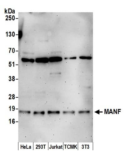 Western Blot:[NBP3-30386]-Detection of human and mouse MANF by western blot. Samples: Whole cell lysate from HeLa, HEK293T, Jurkat, mouse TCMK-1, and mouse NIH 3T3 cells prepared using NETN lysis buffer. Antibody: Affinity purified rabbit anti-MANF antibody used for WB at 0. 1 µg/ml. Detection: Chemiluminescence with an exposure time of 3 minutes.