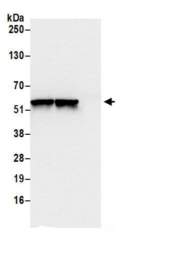 Immunoprecipitation:Dihydrolipoamide Dehydrogenase/DLD AntibodyNBP3-30391] -Detection of human DLD by western blot of immunoprecipitates. Samples: Whole cell lysate (0.5 or 1.0 mg per IP reaction; 20% of IP loaded) from 293T cells prepared using NETN lysis buffer. Antibodies: Affinity purified rabbit anti-DLD antibody NBP3-30391 (lot NBP3-30391-1) used for IP at 6 µg per reaction. DLD was also immunoprecipitated by rabbit anti-DLD antibody BL18459. For blotting immunoprecipitated DLD, NBP3-30391 was used at 0.4 µg/ml. Detection: Chemiluminescence with an exposure time of 1 second.