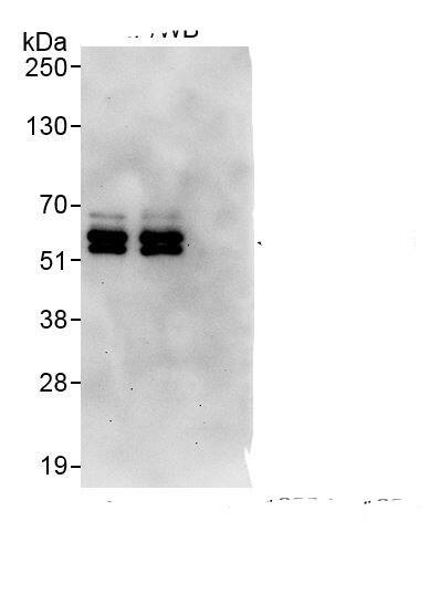 Immunoprecipitation:PPP2R5C AntibodyNBP3-30392] -Detection of human PPP2R5C by western blot of immunoprecipitates. Samples: Whole cell lysate (1 mg for IP, 20% of IP loaded) from HEK293T cells. Antibodies: Affinity purified rabbit anti-PPP2R5C antibody NBP3-30392 (lot NBP3-30392-1) used for IP at 6 µg/mg lysate. PPP2R5C was also immunoprecipitated by rabbit anti-PPP2R5C., which recognizes an upstream epitope. For blotting immunoprecipitated PPP2R5C, NBP3-30392 was used at 1.0 µg/ml. Detection: Chemiluminescence with exposure time of 30 seconds.