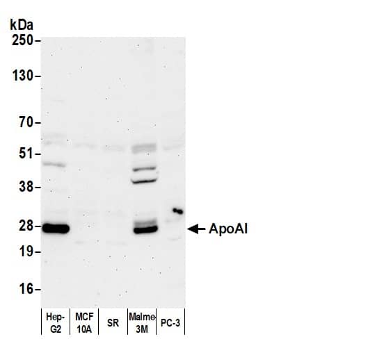 Western Blot:[NBP3-30393]-Detection of human ApoAI by western blot. Samples: Whole cell lysate from Hep-G2, MCF10A, SR, Malme-3M, and PC-3 cells prepared using NETN lysis buffer. Antibody: Affinity Purified Rabbit anti-Human Apo AI [A03R] Antibody used for WB at 1 µg/ml. Secondary: HRP-conjugated Goat anti-Rabbit IgG Heavy and Light Chain Cross-Adsorbed Antibody. Detection: Chemiluminescence with an exposure time of 3 minutes.