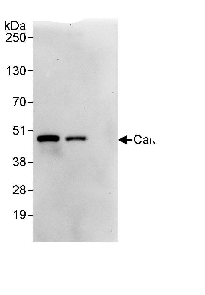 Immunoprecipitation:CAMKID AntibodyNBP3-30397] -Detection of human CaMKI delta by western blot of immunoprecipitates. Samples: Whole cell lysate (1 mg for IP, 20% of IP loaded) from HeLa cells. Antibodies: Affinity purified rabbit anti-CaMKI delta antibody NBP3-30397 used for IP at 3 µg/mg lysate. CaMKI delta was also immunoprecipitated by rabbit anti-CaMKI delta., which recognizes a downstream epitope. For blotting immunoprecipitated CaMKI delta, A302-667A was used at 1 µg/ml. Detection: Chemiluminescence with an exposure time of 30 seconds.