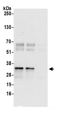 Immunoprecipitation:CWC15 AntibodyNBP3-30399] -Detection of human CWC15 by western blot of immunoprecipitates. Samples: Whole cell lysate (0.5 or 1.0 mg per IP reaction; 20% of IP loaded) from HeLa cells prepared using NETN lysis buffer. Antibodies: Affinity purified rabbit anti-CWC15 antibody NBP3-30399 (lot NBP3-30399-1) used for IP at 6 µg per reaction. CWC15 was also immunoprecipitated by rabbit anti-CWC15.. For blotting immunoprecipitated CWC15, NBP3-30399 was used at 1 µg/ml. Detection: Chemiluminescence with an exposure time of 30 seconds.