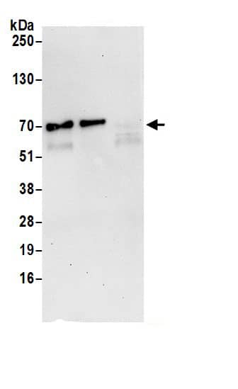 Immunoprecipitation:NUP62 AntibodyNBP3-30400] -Detection of human NUP62 by western blot of immunoprecipitates. Samples: Whole cell lysate (0.5 or 1.0 mg per IP reaction; 20% of IP loaded) from 293T cells prepared using NETN lysis buffer. Antibodies: Affinity purified rabbit anti-NUP62 antibody NBP3-30400 (lot NBP3-30400-1) used for IP at 6 µg per reaction. NUP62 was also immunoprecipitated by rabbit anti-NUP62.. For blotting immunoprecipitated NUP62, NBP3-30400 was used at 0.4 µg/ml. Detection: Chemiluminescence with an exposure time of 30 seconds.