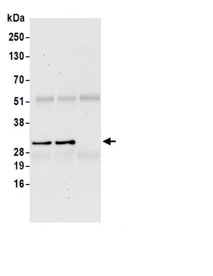 Immunoprecipitation:H1F0 AntibodyNBP3-30401] -Detection of human H1F0/Histone H1 by western blot of immunoprecipitates. Samples: Whole cell lysate (0.5 or 1.0 mg per IP reaction; 20% of IP loaded) from 293T cells prepared using NETN lysis buffer. Antibodies: Affinity purified rabbit anti-H1F0/Histone H1.0 antibody NBP3-30401 (lot NBP3-30401-1) used for IP at 6 µg per reaction. H1F0/Histone H1.0 was also immunoprecipitated by rabbit anti-H1F0/Histone H1.0 antibody. For blotting immunoprecipitated H1F0/Histone H1.0, NBP3-30401 was used at 1 µg/ml. Detection: Chemiluminescence with an exposure time of 3 minutes.