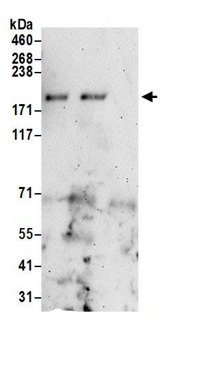 Immunoprecipitation:SSFA2 AntibodyNBP3-30402] -Detection of human KRAP by western blot of immunoprecipitates. Samples: Whole cell lysate (0.5 or 1.0 mg per IP reaction; 20% of IP loaded) from 293T cells prepared using NETN lysis buffer. Antibodies: Affinity purified rabbit anti-KRAP antibody NBP3-30402 (lot NBP3-30402-1) used for IP at 6 µg per reaction. KRAP was also immunoprecipitated by rabbit anti-KRAP antibody. For blotting immunoprecipitated KRAP, NBP3-30402 was used at 1 µg/ml. Detection: Chemiluminescence with an exposure time of 3 minutes.