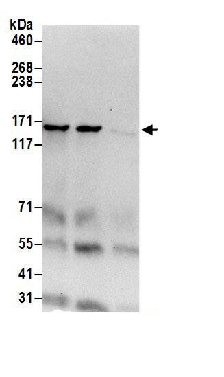 Immunoprecipitation:Isoleucyl tRNA synthetase AntibodyNBP3-30404] -Detection of human IARS by western blot of immunoprecipitates. Samples: Whole cell lysate (0.5 or 1.0 mg per IP reaction; 20% of IP loaded) from 293T cells prepared using NETN lysis buffer. Antibodies: Affinity purified rabbit anti-IARS antibody NBP3-30404 (lot NBP3-30404-1) used for IP at 6 µg per reaction. IARS was also immunoprecipitated by rabbit anti-IARS antibody BL18492. For blotting immunoprecipitated IARS, NBP3-30404 was used at 1 µg/ml. Detection: Chemiluminescence with an exposure time of 30 seconds.