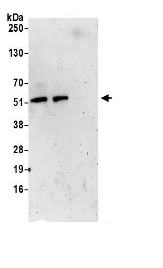 Immunoprecipitation:PMPCA AntibodyNBP3-30405] -Detection of human PMPCA by western blot of immunoprecipitates. Samples: Whole cell lysate (0.5 or 1.0 mg per IP reaction; 20% of IP loaded) from 293T cells prepared using NETN lysis buffer. Antibodies: Affinity purified rabbit anti-PMPCA antibody NBP3-30405 (lot NBP3-30405-1) used for IP at 6 µg per reaction. PMPCA was also immunoprecipitated by rabbit anti-PMPCA.. For blotting immunoprecipitated PMPCA, NBP3-30405 was used at 1 µg/ml. Detection: Chemiluminescence with an exposure time of 3 minutes.