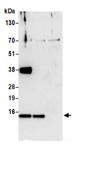 Immunoprecipitation:COX5b AntibodyNBP3-30406] -Detection of human COX5B by western blot of immunoprecipitates. Samples: Whole cell lysate (0.5 or 1.0 mg per IP reaction; 20% of IP loaded) from 293T cells prepared using NETN lysis buffer. Antibodies: Affinity purified rabbit anti-COX5B antibody NBP3-30406 (lot NBP3-30406-1) used for IP at 6 µg per reaction. COX5B was also immunoprecipitated by rabbit anti-COX5B.. For blotting immunoprecipitated COX5B, NBP3-30406 was used at 0.4 µg/ml. Detection: Chemiluminescence with an exposure time of 30 seconds.