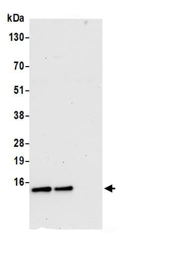 Immunoprecipitation:COX5b AntibodyNBP3-30407] -Detection of human COX5B by western blot of immunoprecipitates. Samples: Whole cell lysate (0.5 or 1.0 mg per IP reaction; 20% of IP loaded) from 293T cells prepared using NETN lysis buffer. Antibodies: Affinity purified rabbit anti-COX5B antibody NBP3-30407 (lot NBP3-30407-1) used for IP at 6 µg per reaction. COX5B was also immunoprecipitated by rabbit anti-COX5B.. For blotting immunoprecipitated COX5B, NBP3-30407 was used at 0.4 µg/ml. Detection: Chemiluminescence with an exposure time of 30 seconds.