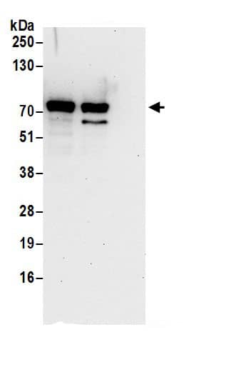 Immunoprecipitation:Epsin 1 AntibodyNBP3-30410] -Detection of human Epsin 1 by western blot of immunoprecipitates. Samples: Whole cell lysate (0.5 or 1.0 mg per IP reaction; 20% of IP loaded) from 293T cells prepared using NETN lysis buffer. Antibodies: Affinity purified rabbit anti-Epsin 1 antibody NBP3-30410 (lot NBP3-30410-1) used for IP at 6 µg per reaction. Epsin 1 was also immunoprecipitated by rabbit anti-Epsin 1.. For blotting immunoprecipitated Epsin 1, NBP3-30410 was used at 1 µg/ml. Detection: Chemiluminescence with an exposure time of 30 seconds.