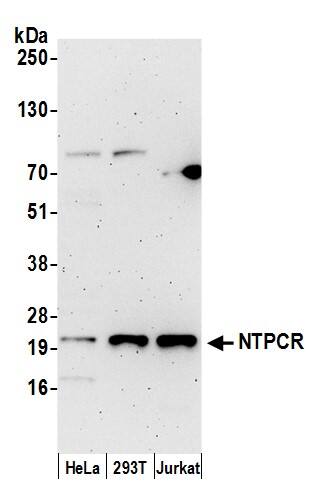 Western Blot:[NBP3-30411]-Detection of human NTPCR by western blot. Samples: Whole cell lysate from HeLa, HEK293T, and Jurkat cells prepared using NETN lysis buffer. Antibody: Affinity purified rabbit anti-NTPCR antibody used for WB at 0. 04 mg/ml. Detection: Chemiluminescence with an exposure time of 3 minutes.