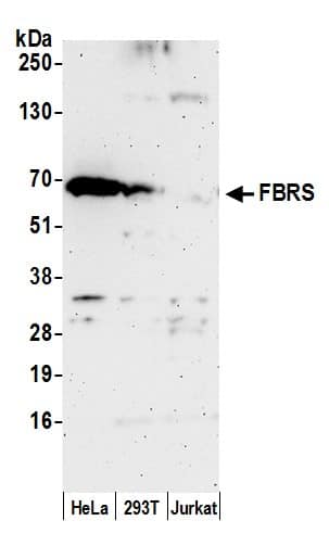 Western Blot FBRS Antibody