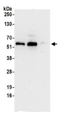 Immunoprecipitation:AAAS AntibodyNBP3-30415] -Detection of human Aladin by western blot of immunoprecipitates. Samples: Whole cell lysate (0.5 or 1.0 mg per IP reaction; 20% of IP loaded) from 293T cells prepared using NETN lysis buffer. Antibodies: Affinity purified rabbit anti-Aladin antibody NBP3-30415 (lot NBP3-30415-1) used for IP at 6 µg per reaction. Aladin was also immunoprecipitated by rabbit anti-Aladin antibody BL17071. For blotting immunoprecipitated Aladin, NBP3-30415 was used at 1 µg/ml. Detection: Chemiluminescence with an exposure time of 30 seconds.