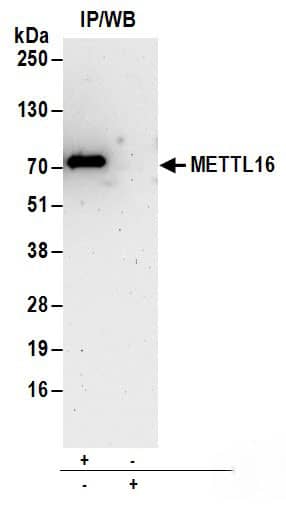 Immunoprecipitation:[NBP3-30418]-Detection of human METTL16 by western blot of immunoprecipitates. Samples: Whole cell lysate from HeLa cells. Antibodies: Affinity purified rabbit anti-METTL16 antibody used for IP at 6 µg/mg lysate. For blotting immunoprecipitated METTL16, was used at 1 µg/ml. Detection: Chemiluminescence with an exposure time of 3 minutes.