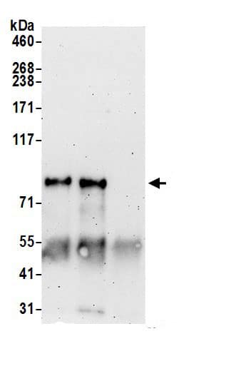 Immunoprecipitation:ATXN1L AntibodyNBP3-30420] -Detection of human ATXN1L by western blot of immunoprecipitates. Samples: Whole cell lysate (0.5 or 1.0 mg per IP reaction; 20% of IP loaded) from HeLa cells prepared using NETN lysis buffer. Antibodies: Affinity purified rabbit anti-ATXN1L antibody NBP3-30420 (lot NBP3-30420-1) used for IP at 6 µg per reaction. ATXN1L was also immunoprecipitated by rabbit anti-ATXN1L antibody BL20280. For blotting immunoprecipitated ATXN1L, NBP3-30420 was used at 0.4 µg/ml. Detection: Chemiluminescence with an exposure time of 3 minutes.
