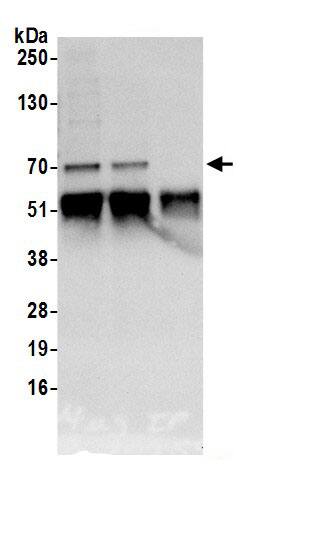 Immunoprecipitation:RNPC3 AntibodyNBP3-30421] -Detection of human RNPC3 by western blot of immunoprecipitates. Samples: Whole cell lysate (0.5 or 1.0 mg per IP reaction; 20% of IP loaded) from HeLa cells prepared using NETN lysis buffer. Antibodies: Affinity purified rabbit anti-RNPC3 antibody NBP3-30421 (lot NBP3-30421-1) used for IP at 6 µg per reaction. RNPC3 was also immunoprecipitated by rabbit anti-RNPC3 antibody BL20260. For blotting immunoprecipitated RNPC3, NBP3-30421 was used at 0.4 µg/ml. Detection: Chemiluminescence with an exposure time of 10 seconds.