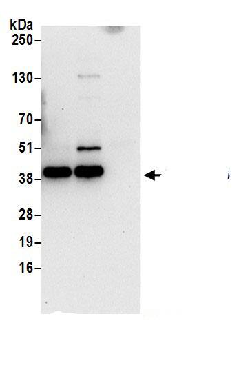 Immunoprecipitation:Serpin B6 AntibodyNBP3-30423] -Detection of human SERPINB6 by western blot of immunoprecipitates. Samples: Whole cell lysate (0.5 or 1.0 mg per IP reaction; 20% of IP loaded) from HeLa cells prepared using NETN lysis buffer. Antibodies: Affinity purified rabbit anti-SERPINB6 antibody NBP3-30423 (lot NBP3-30423-1) used for IP at 6 µg per reaction. SERPINB6 was also immunoprecipitated by rabbit anti-SERPINB6 antibody. For blotting immunoprecipitated SERPINB6, NBP3-30423 was used at 0.4 µg/ml. Detection: Chemiluminescence with an exposure time of 30 seconds.