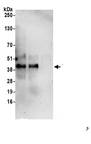 Immunoprecipitation:Mitochondrial fission regulator 1 AntibodyNBP3-30424] -Detection of human MTFR1 by western blot of immunoprecipitates. Samples: Whole cell lysate (1.0 mg per IP reaction; 20% of IP loaded) from HeLa cells prepared using NETN lysis buffer. Antibodies: Affinity purified rabbit anti-MTFR1 antibody (NBP3-30424 lot 1) used for IP at 6 µg per reaction. MTFR1 was also immunoprecipitated by rabbit anti-MTFR1.. For blotting immunoprecipitated MTFR1, NBP3-30424 was used at 0.4 mg/ml. Detection: Chemiluminescence with an exposure time of 3 minutes.