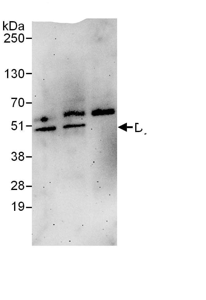 Immunoprecipitation:Dysbindin AntibodyNBP3-30425] -Detection of human Dysbindin1 by western blot of immunoprecipitates. Samples: Whole cell lysate from HeLa (1 mg for IP, 20% of IP loaded) cells. Antibodies: Affinity purified rabbit anti-Dysbindin1 antibody NBP3-30425 used for IP at 6 µg/mg lysate. Dysbindin1 was also immunoprecipitated by rabbit anti-Dysbindin1., which recognizes a downstream epitope. For blotting immunoprecipitated Dysbindin1,  was used at 1 µg/ml. Detection: Chemiluminescence with an exposure time of 3 minutes.