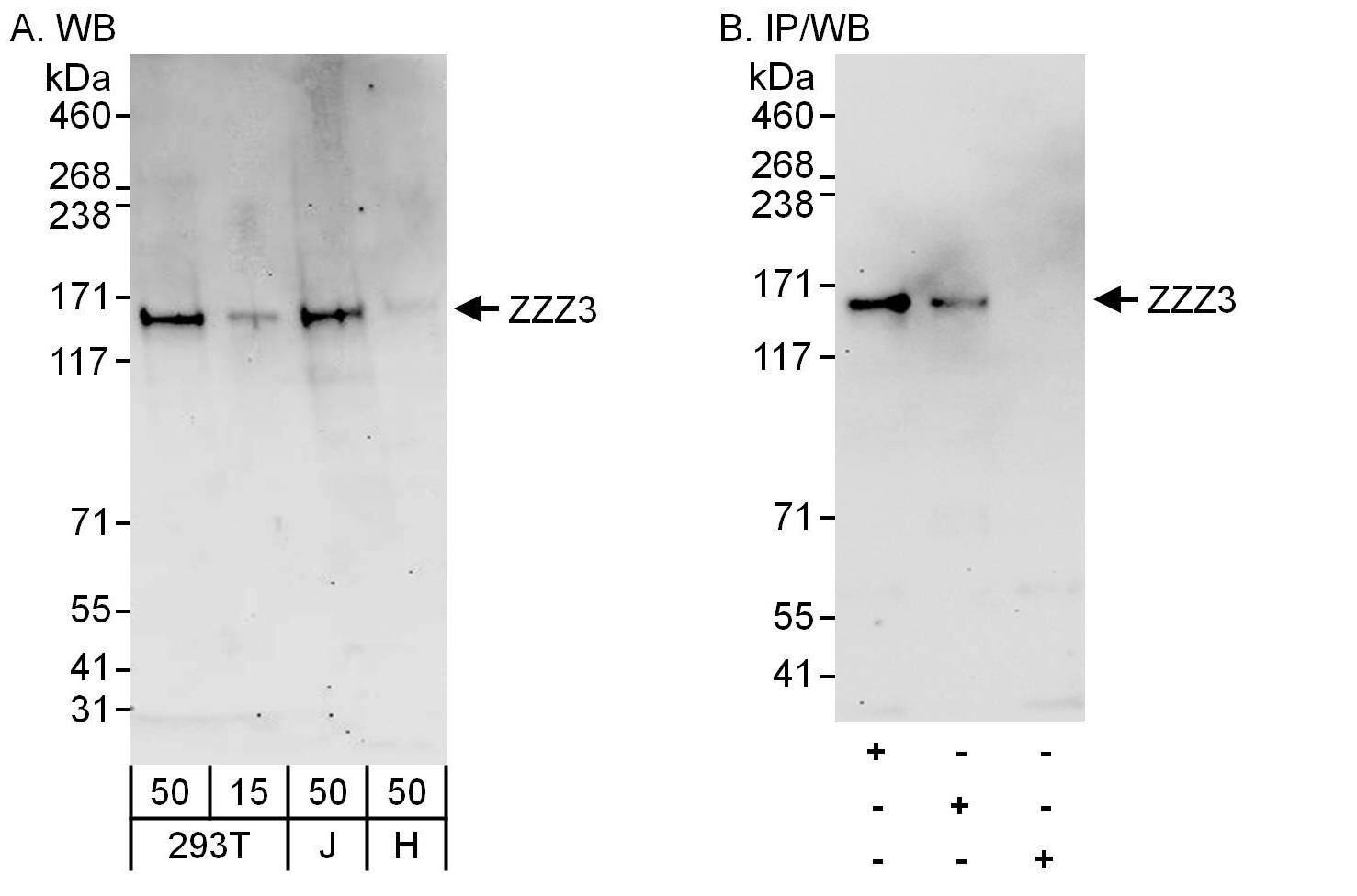 Western Blot ZZZ3 Antibody - BSA Free