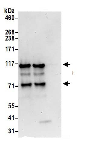Immunoprecipitation:Drebrin 1 AntibodyNBP3-30427] -Detection of human Drebrin by western blot of immunoprecipitates. Samples: Whole cell lysate (0.5 or 1.0 mg per IP reaction; 20% of IP loaded) from 293T cells prepared using NETN lysis buffer. Antibodies: Affinity purified rabbit anti-Drebrin antibody NBP3-30427 (lot NBP3-30427-1) used for IP at 6 µg per reaction. Drebrin was also immunoprecipitated by rabbit anti-Drebrin antibody BL17077. For blotting immunoprecipitated Drebrin, NBP3-30427 was used at 1 µg/ml. Detection: Chemiluminescence with an exposure time of 30 seconds.