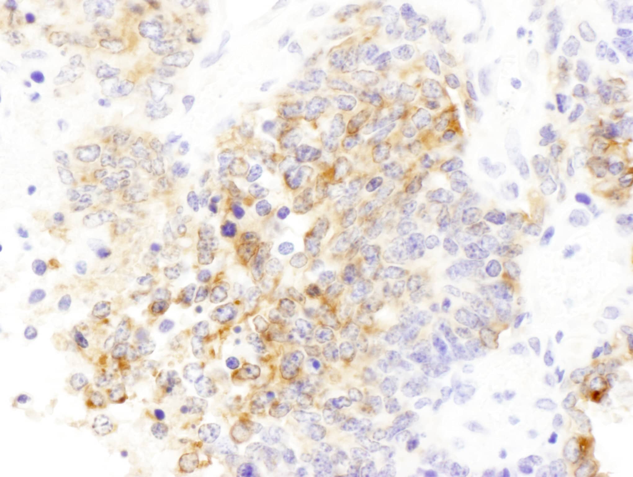 Immunohistochemistry;Drebrin 1 Antibody[NBP3-30427]Detection of mouse Drebrin by immunohistochemistry. Sample: FFPE section of mouse teratoma. Antibody: Affinity purified rabbit anti-Drebrin  used at a dilution of 1:1,000 . Detection: DAB