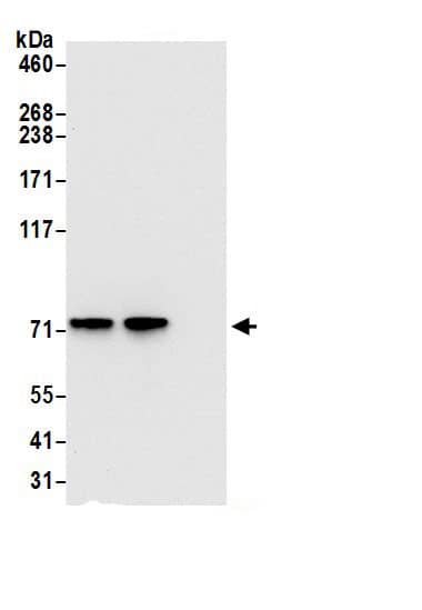 Immunoprecipitation:TRAP1 AntibodyNBP3-30428] -Detection of human TRAP1/HSP75 by western blot of immunoprecipitates. Samples: Whole cell lysate (0.5 or 1.0 mg per IP reaction; 20% of IP loaded) from 293T cells prepared using NETN lysis buffer. Antibodies: Affinity purified rabbit anti-TRAP1/HSP75 antibody NBP3-30428 (lot NBP3-30428-1) used for IP at 6 µg per reaction. TRAP1/HSP75 was also immunoprecipitated by rabbit anti-TRAP1/HSP75.. For blotting immunoprecipitated TRAP1/HSP75, NBP3-30428 was used at 0.4 µg/ml. Detection: Chemiluminescence with an exposure time of 10 seconds.