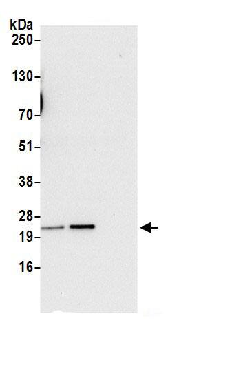 Immunoprecipitation:Synaptobrevin homolog YKT6 AntibodyNBP3-30433] -Detection of human YKT6 by western blot of immunoprecipitates. Samples: Whole cell lysate (0.5 or 1.0 mg per IP reaction; 20% of IP loaded) from 293T cells prepared using NETN lysis buffer. Antibodies: Affinity purified rabbit anti-YKT6 antibody NBP3-30433 (lot NBP3-30433-1) used for IP at 6 µg per reaction. YKT6 was also immunoprecipitated by rabbit anti-YKT6.. For blotting immunoprecipitated YKT6, NBP3-30433 was used at 1 µg/ml. Detection: Chemiluminescence with an exposure time of 30 seconds.