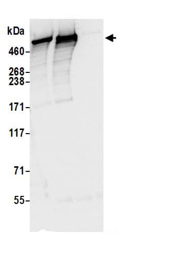 Immunoprecipitation:DYNC1H1 AntibodyNBP3-30435] -Detection of human DYNC1H1 by western blot of immunoprecipitates. Samples: Whole cell lysate (0.5 or 1.0 mg per IP reaction; 20% of IP loaded) from 293T cells prepared using NETN lysis buffer. Antibodies: Affinity purified rabbit anti-DYNC1H1 antibody NBP3-30435 (lot NBP3-30435-1) used for IP at 6 µg per reaction. DYNC1H1 was also immunoprecipitated by rabbit anti-DYNC1H1 antibody BL18366. For blotting immunoprecipitated DYNC1H1, NBP3-30435 was used at 0.4 µg/ml. Detection: Chemiluminescence with an exposure time of 3 seconds.