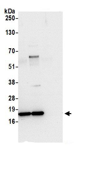 Immunoprecipitation:NDUFB6 AntibodyNBP3-30436] -Detection of human NDUFB6 by western blot of immunoprecipitates. Samples: Whole cell lysate (0.5 or 1.0 mg per IP reaction; 20% of IP loaded) from 293T cells prepared using NETN lysis buffer. Antibodies: Affinity purified rabbit anti-NDUFB6 antibody NBP3-30436 (lot NBP3-30436-1) used for IP at 6 µg per reaction. NDUFB6 was also immunoprecipitated by rabbit anti-NDUFB6.. For blotting immunoprecipitated NDUFB6, NBP3-30436 was used at 1 µg/ml. Detection: Chemiluminescence with an exposure time of 10 seconds.