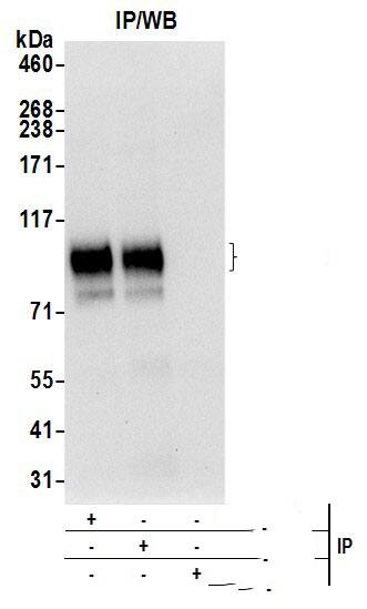 Immunoprecipitation:[NBP3-30437]-Detection of human by western blot of immunoprecipitates. Samples: Whole cell lysate from 293T cells prepared using NETN lysis buffer. Antibodies: Affinity purified rabbit antibody used for IP at 6 µg per reaction. was also immunoprecipitated by rabbit antibody. For blotting immunoprecipitated , was used at 0. 4 µg/ml. Detection: Chemiluminescence with an exposure time of 10 seconds.