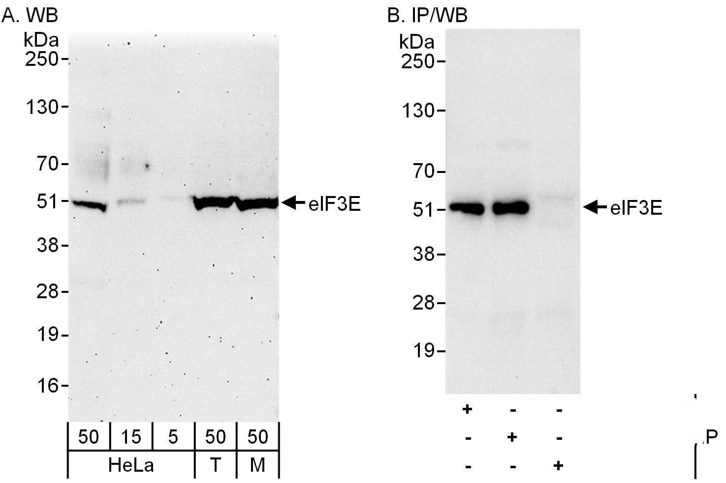 Western Blot:[NBP3-30440]-Detection of human and mouse eIF3E by western blot and immunoprecipitation. Samples: Whole cell lysate from HeLa , HEK293T and mouse NIH 3T3 cells. Antibodies: Affinity purified rabbit anti-eIF3E antibody used for WB at 0. 1 µg/ml and 1 µg/ml and used for IP at 3 µg/mg lysate. eIF3E was also immunoprecipitated by rabbit anti-eIF3E antibody , which recognizes a downstream epitope. Detection: Chemiluminescence with exposure times of 3 minutes and 10 seconds.