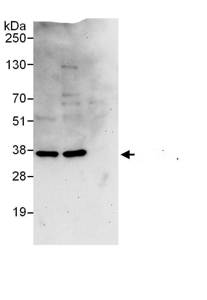 Immunoprecipitation:PSMD14 AntibodyNBP3-30443] -Detection of human PSMD14 by western blot of immunoprecipitates. Samples: Whole cell lysate (1 mg for IP; 20% of IP loaded) from HEK293T cells. Antibodies: Affinity purified rabbit anti-PSMD14 antibody NBP3-30443 (lot NBP3-30443-1) used for IP at 6 µg/mg lysate. PSMD14 was also immunoprecipitated by rabbit anti-PSMD14 antibody. For blotting immunoprecipitated PSMD14, NBP3-30443 was used at 1 µg/ml. Detection: Chemiluminescence with an exposure time of 30 seconds.