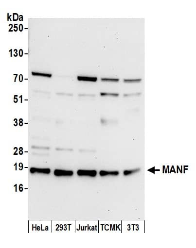 Western Blot:[NBP3-30447]-Detection of human and mouse MANF by western blot. Samples: Whole cell lysate from HeLa, HEK293T, Jurkat, mouse TCMK-1, and mouse NIH 3T3 cells prepared using NETN lysis buffer. Antibody: Affinity purified rabbit anti-MANF antibody used for WB at 0. 1 µg/ml. Detection: Chemiluminescence with an exposure time of 30 seconds.