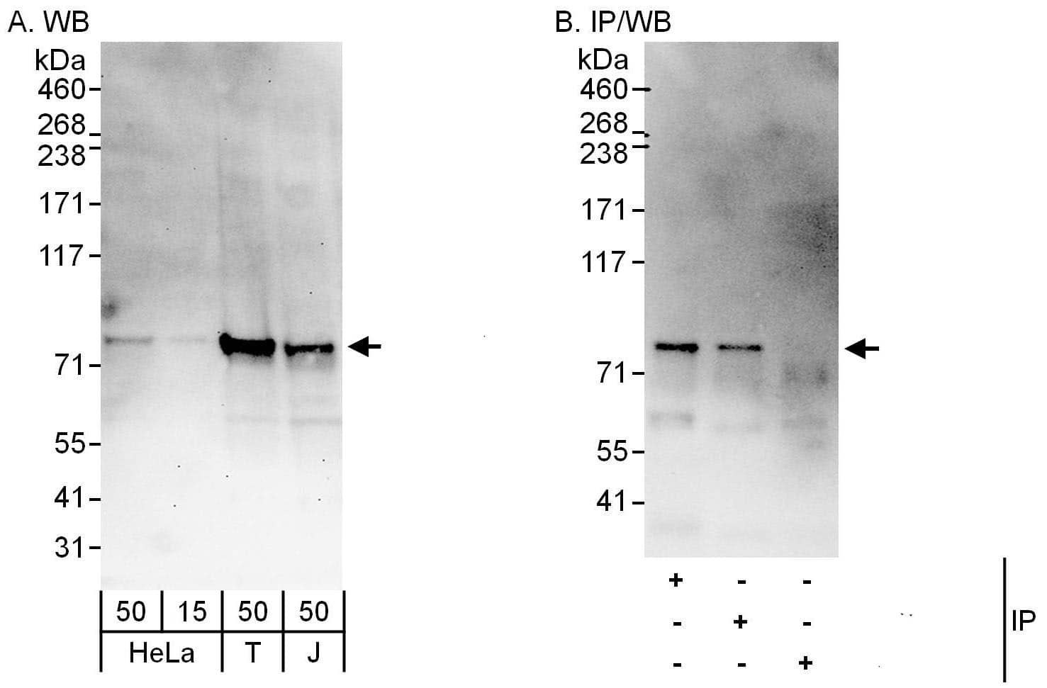 Western Blot:[NBP3-30448]-Detection of human CENP-I by western blot and immunoprecipitation. Samples: Whole cell lysate from HeLa , HEK293T and Jurkat cells. Antibodies: Affinity purified rabbit anti-CENP-I antibody used for WB at 0. 1 µg/ml and 0. 4 µg/ml and used for IP at 6 µg/mg lysate. CENP-I was also immunoprecipitated by rabbit anti-CENP-I antibody , which recognizes a downstream epitope. Detection: Chemiluminescence with exposure times of 30 seconds and 10 seconds.