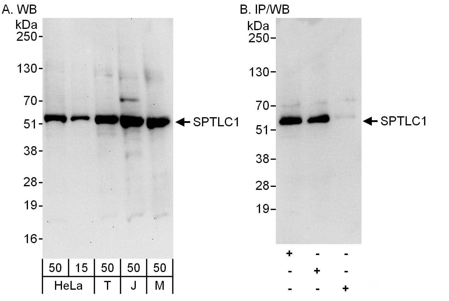 Western Blot:[NBP3-30449]-Detection of human and mouse SPTLC1 by western blot and immunoprecipitation. Samples: Whole cell lysate from HeLa , HEK293T , Jurkat and mouse NIH 3T3 cells. Antibodies: Affinity purified rabbit anti-SPTLC1 antibody used for WB at 0. 04 µg/ml and 0. 4 µg/ml and used for IP at 6 µg/mg lysate. SPTLC1 was also immunoprecipitated by rabbit anti-SPTLC1 antibody , which recognizes a downstream epitope. Detection: Chemiluminescence with exposure times of 30 seconds and 10 seconds.