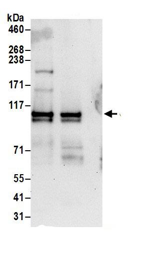 Immunoprecipitation:Zeta Opioid Receptor AntibodyNBP3-30451] -Detection of human OGFR by western blot of immunoprecipitates. Samples: Whole cell lysate (0.5 or 1.0 mg per IP reaction; 20% of IP loaded) from 293T cells prepared using NETN lysis buffer. Antibodies: Affinity purified rabbit anti-OGFR antibody NBP3-30451 (lot NBP3-30451-1) used for IP at 6 µg per reaction. OGFR was also immunoprecipitated by rabbit anti-OGFR antibody BL17209. For blotting immunoprecipitated OGFR, NBP3-30451 was used at 1 µg/ml. Detection: Chemiluminescence with an exposure time of 30 seconds.