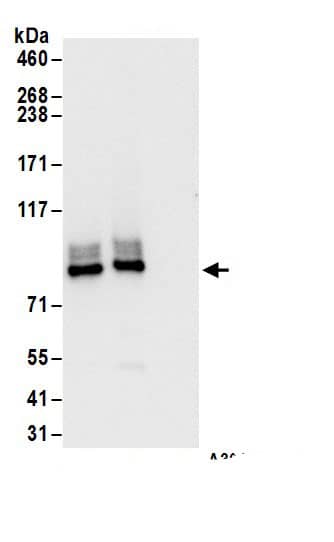Immunoprecipitation:PKC eta AntibodyNBP3-30454] -Detection of human PKC-eta by western blot of immunoprecipitates. Samples: Whole cell lysate (1 mg for IP; 20% of IP loaded) from Jurkat cells. Antibodies: Affinity purified rabbit anti-PKC-eta antibody NBP3-30454 (lot NBP3-30454-1) used for IP at 6 µg/mg lysate. PKC-eta was also immunoprecipitated by rabbit anti-PKC-eta.. For blotting immunoprecipitated PKC-eta, A304-236A was used at 1 µg/ml. Detection: Chemiluminescence with an exposure time of 3 seconds.