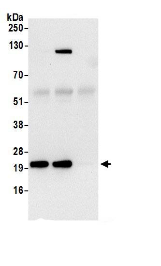 Immunoprecipitation:RPL18A AntibodyNBP3-30455] -Detection of human RPL18A by western blot of immunoprecipitates. Samples: Whole cell lysate (0.5 or 1.0 mg per IP reaction; 20% of IP loaded) from 293T cells prepared using NETN lysis buffer. Antibodies: Affinity purified rabbit anti-RPL18A antibody NBP3-30455 (lot NBP3-30455-1) used for IP at 6 µg per reaction. RPL18A was also immunoprecipitated by rabbit anti-RPL18A.. For blotting immunoprecipitated RPL18A, NBP3-30455 was used at 0.4 µg/ml. Detection: Chemiluminescence with an exposure time of 30 seconds.