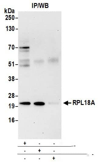 Immunoprecipitation:[NBP3-30456]-Detection of human RPL18A by western blot of immunoprecipitates. Samples: Whole cell lysate from 293T cells prepared using NETN lysis buffer. Antibodies: Affinity purified rabbit antibody used for IP at 6 µg per reaction. RPL18A was also immunoprecipitated by rabbit antibody. For blotting immunoprecipitated RPL18A, was used at 0. 4 µg/ml. Detection: Chemiluminescence with an exposure time of 30 seconds.
